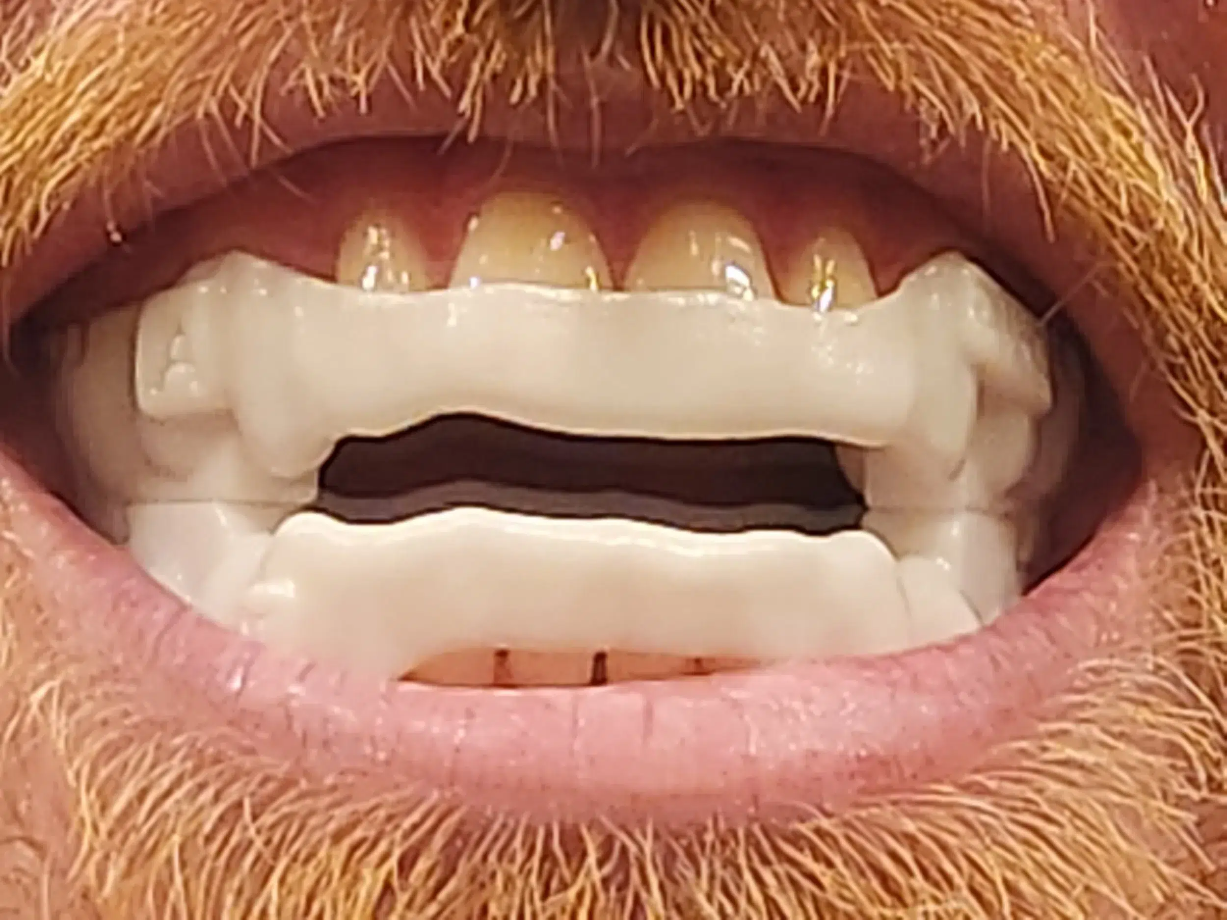 Sleep Dentistry in Litchfield, MI 1 1784762341 20250928 210836 1 1