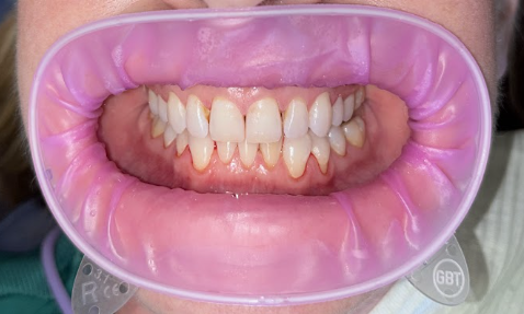 Hawkes Dental 8 Screenshot 2026 08 26 at 1.24.31 PM e1787816797639